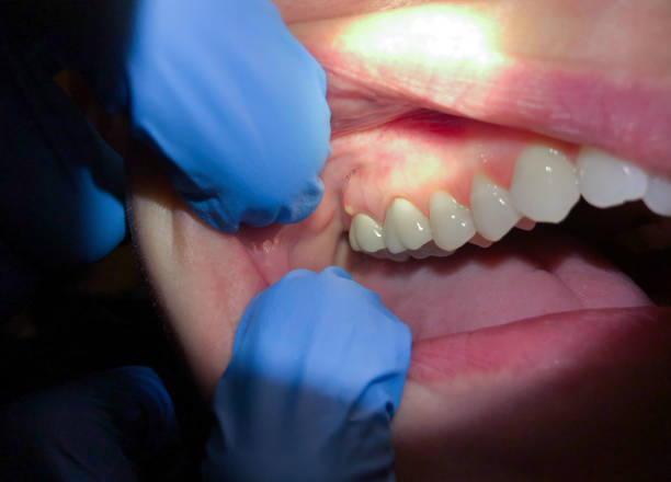 Best Emergency TMJ Treatment in Asheboro, NC