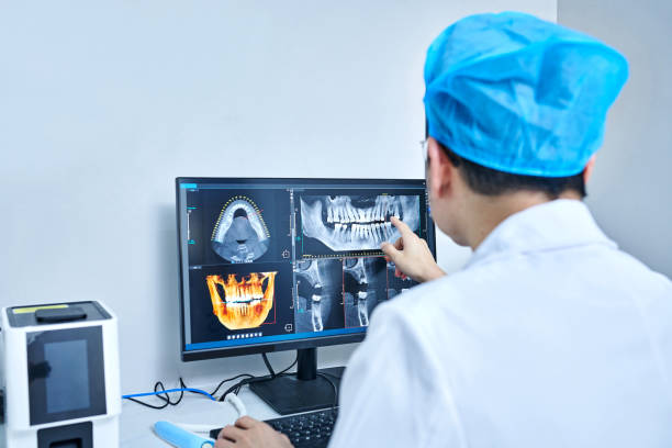 Best Emergency Wisdom Teeth Removal in Asheboro, NC