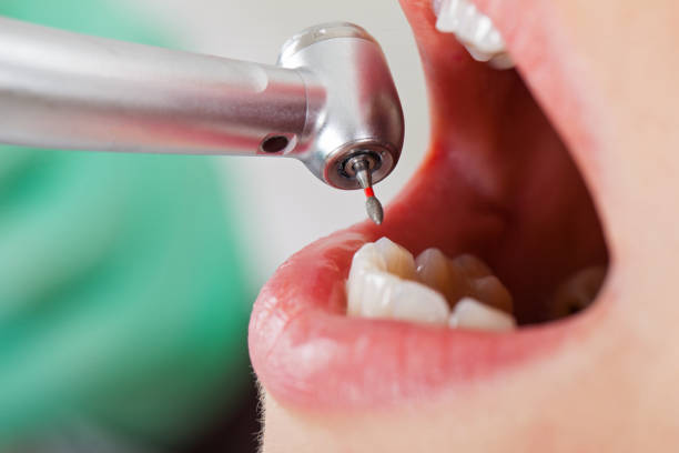 Best Emergency Denture Repair in Asheboro, NC